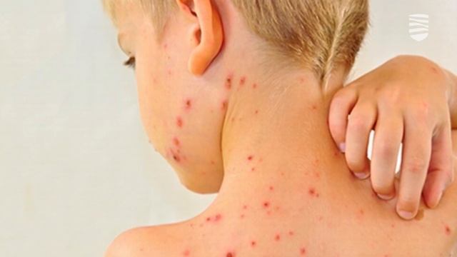 02.05.2024 │ На инфочасе родители получили ответы о вакцинации детей смотреть онлайн