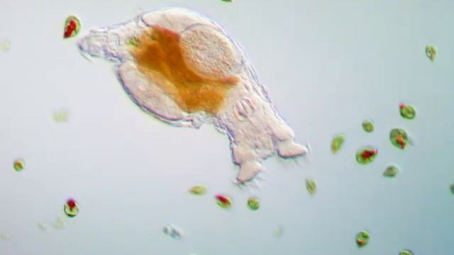 Rotifer - Philodina Roseola