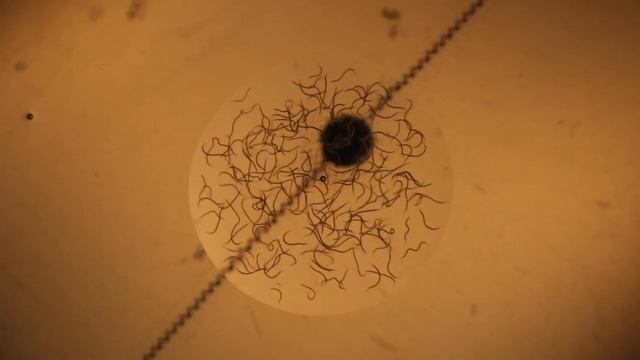 Steinernema sp. nematodes under the microscope смотреть онлайн