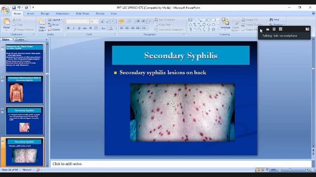 Spirochetes смотреть онлайн