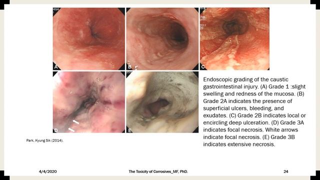 Toxicity Of Corrosives By Dr. Maha Farid, PhD., Faculty Of Medicine, Helwan University, Egypt.