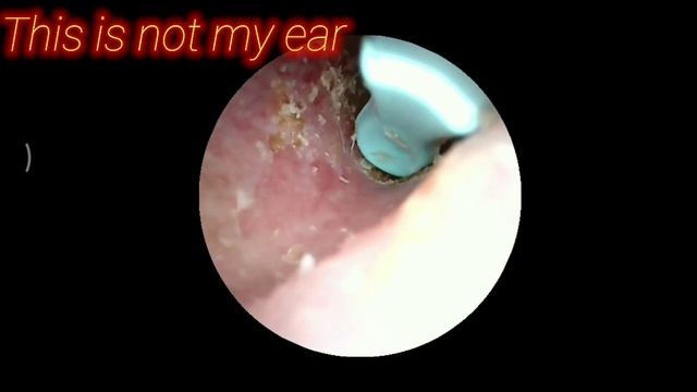 Bebird Smart Visual Camera Ear Cleaner смотреть онлайн