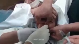 Малыш проглотил монетку