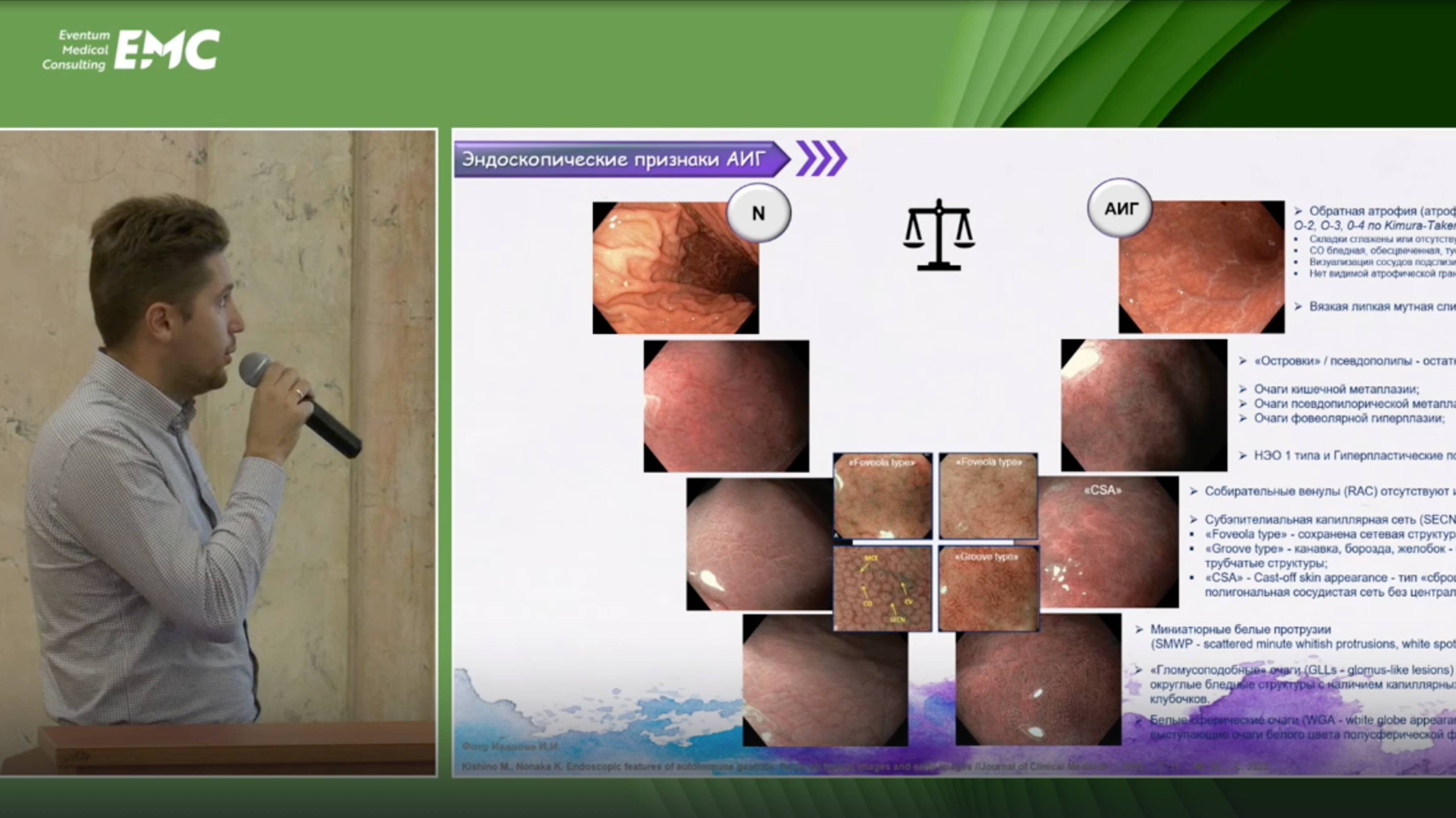 3 Иванов ИИ Агейкина НВ Ранний аутоиммунный атрофический гастрит. Возможно ли нам его распознать?