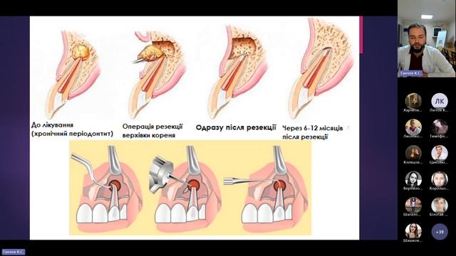 III.3 - Загальна характеристика запальних захворювань ЩЛД смотреть онлайн