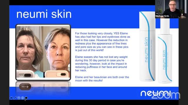 Complete Neumi Presentation By Ray Donnelly And Michael Firth