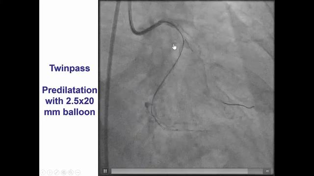 Case 21: Manual of CTO Interventions - Ensuring true lumen wire position смотреть онлайн