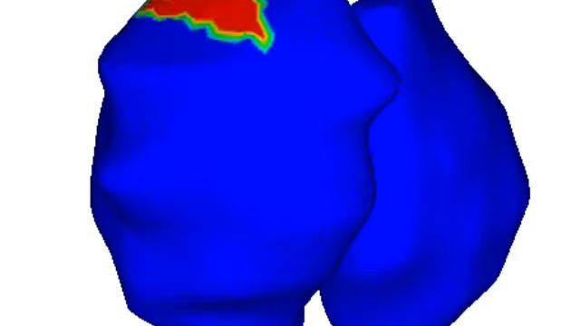 Wavelets Afib смотреть онлайн