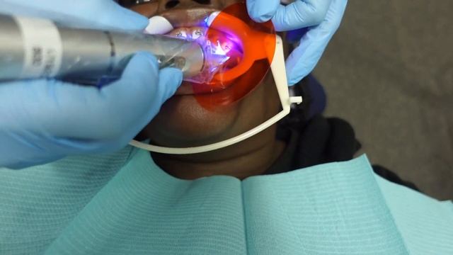 Getting Braces 2023 | NicoleXNicolee _ смотреть онлайн
