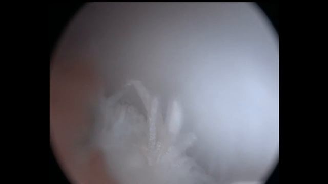Stiffle arthroscopy, dog (артроскопия коленного сустава у собаки) смотреть онлайн