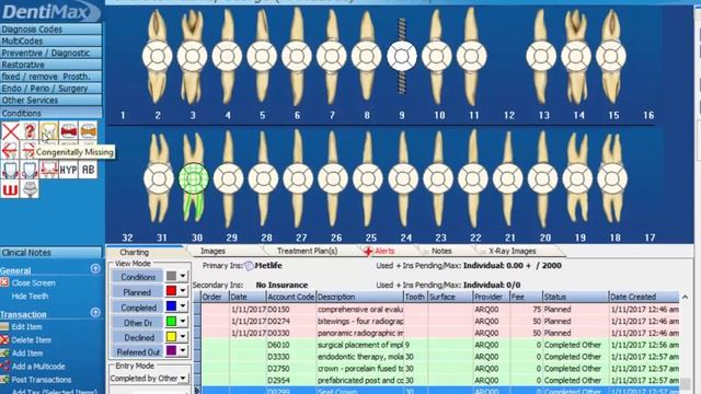DentiMax Dental Software Demo and Walk Through смотреть онлайн