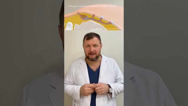 Стоит ли лечить кисту копчика лазером? | ПРОКТОЛОГ ЕФИМ ХАРАБЕТ смотреть онлайн