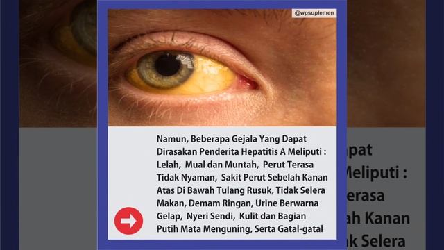 WASPADA GEJALA HEPATITIS A смотреть онлайн