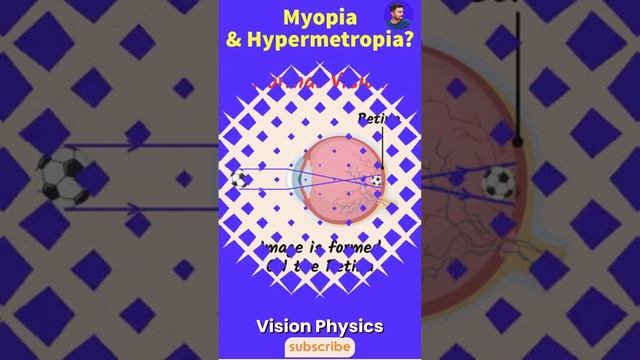 Myopia and Hypermetropia #physics #vision #visionclasses #class12physics #education #electric смотреть онлайн
