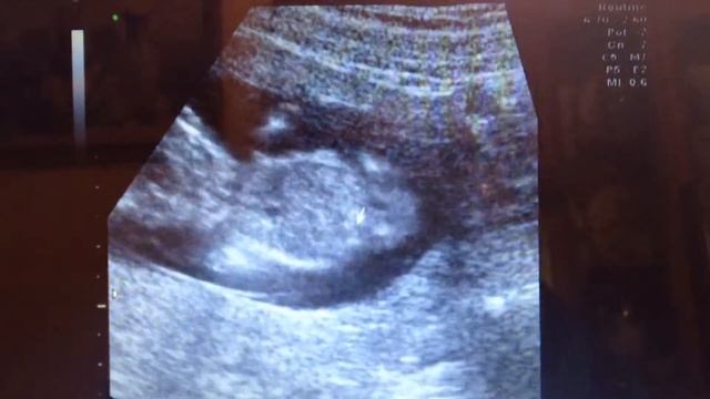 Tamal 2 смотреть онлайн