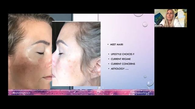 Skin Pigmentation Webinar смотреть онлайн
