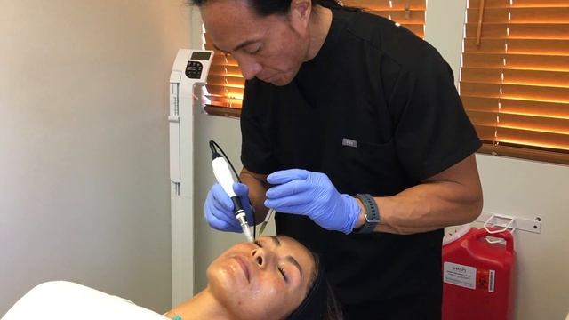 Nurse Rommell: Platelet Rich Plasma (PRP) & Microneedling 10/12/18 смотреть онлайн