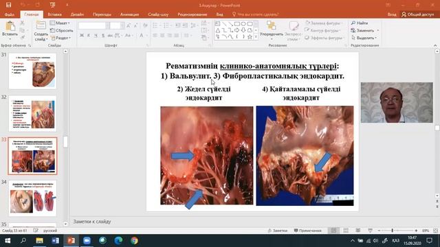 Жүрек ақаулары смотреть онлайн