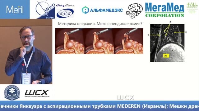 Нечай Т. Острый аппендицит смотреть онлайн