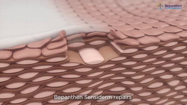 Don't Let Eczema Hold You Back Relieve Eczema Symptoms With Bepanthen Sensiderm And Sensidaily
