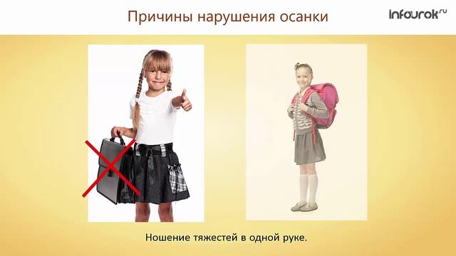 16. Нарушения опорно-двигательной системы смотреть онлайн