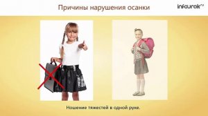 16. Нарушения опорно-двигательной системы