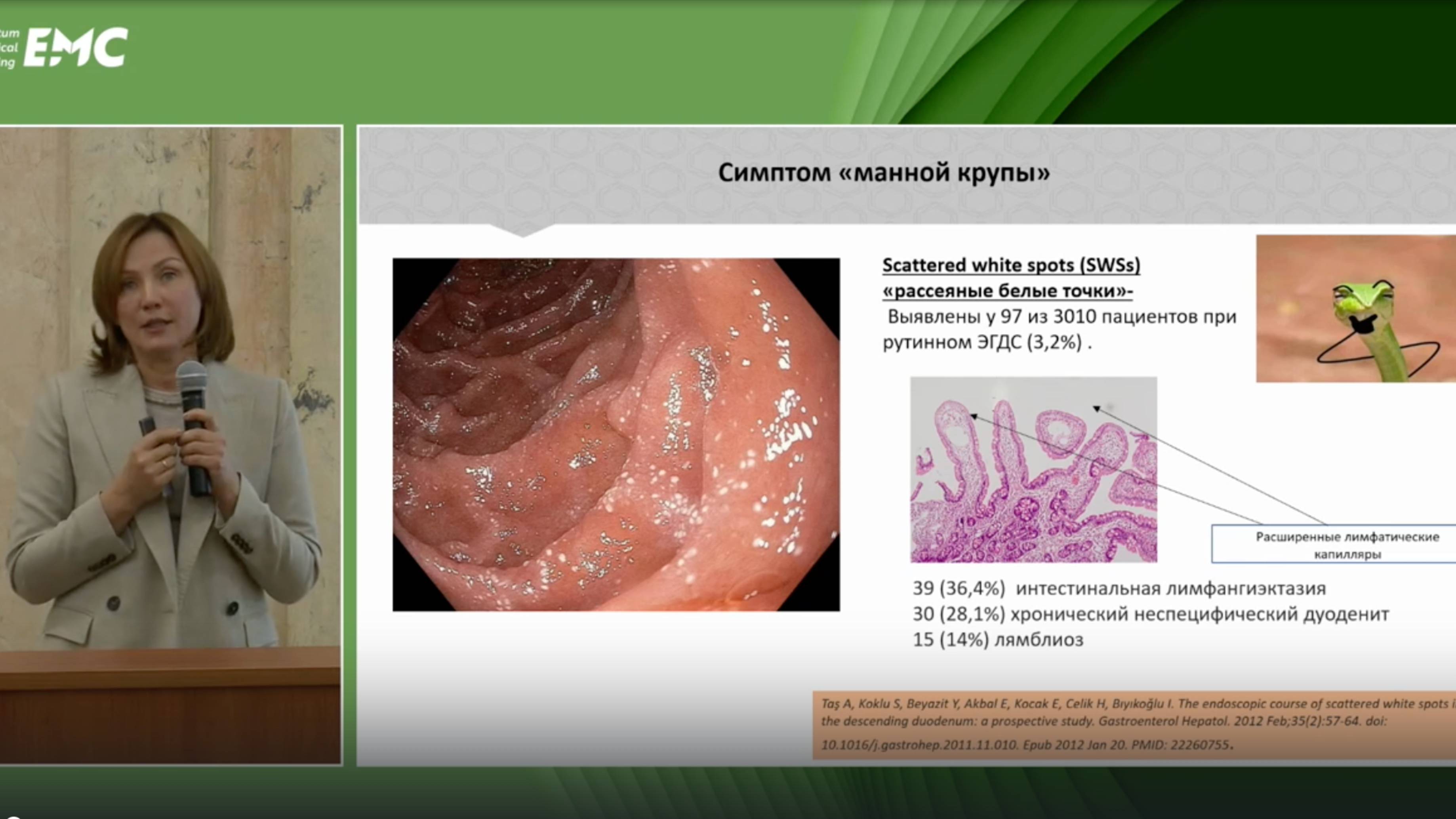 4. Парфенчикова Е.В. Хронический панкреатит с позиции врача эндоскопической диагностики.