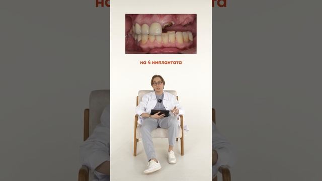 All On 4 - До и после. Врач стоматолог-ортопед Кирилл Хомчук.