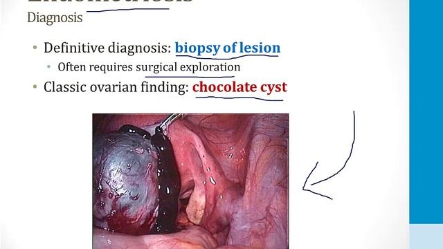 Reproductive - 3. Vagina, Cervix, Uterus - 4.Endometriosis atf смотреть онлайн