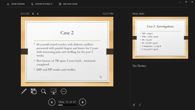 Dr Asanka Nugaliyadde - Case discussion on Gout, Dr Suren de Silva and Dr Gowry Mudiyanse - 2020/9/
