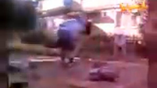 Синдром бешенства