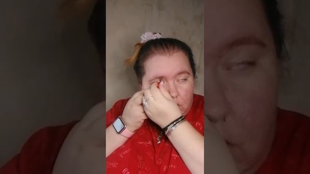 установка, уход и изъятие глазного протеза смотреть онлайн