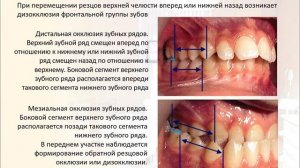 03 Классификация ЗЧА