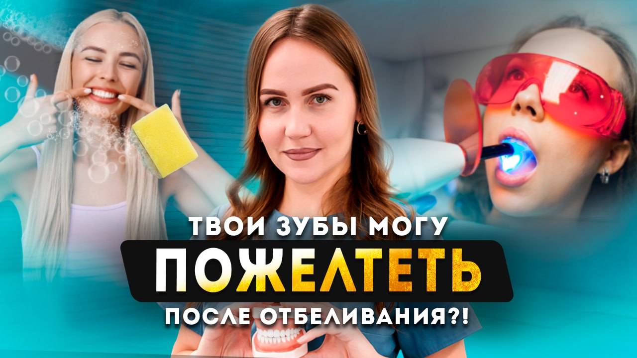 Отбеливание зубов в стоматологии. ВСЕ что нужно знать об отбеливании зубов смотреть онлайн