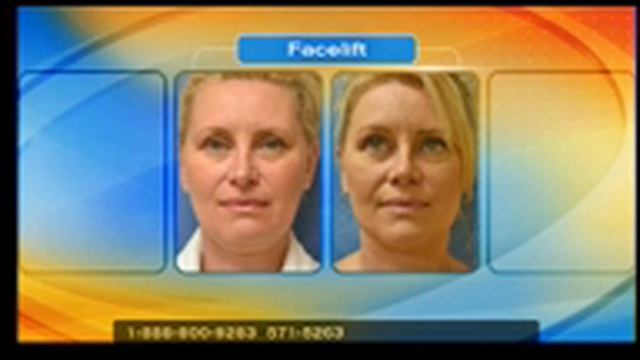 Dermal Needling Before and After 3 смотреть онлайн