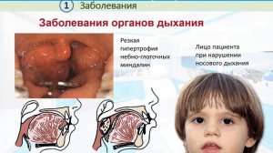 04 Этиология ЗЧА