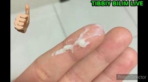 Homiladorlikda vedeleniya kelishi. Хомиладорликда веделения келиши