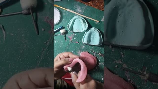 Trimming of mandibular trial denture base, with some tricks.#trialdenture #prosthodontic смотреть онлайн