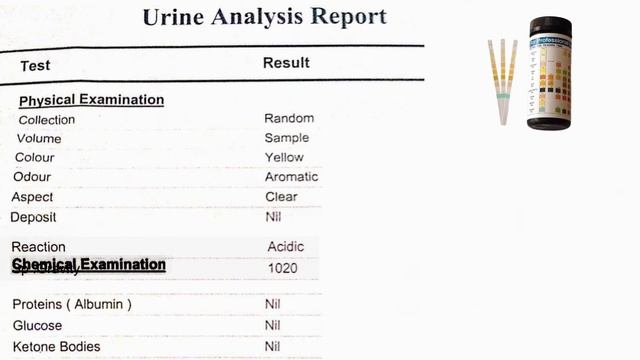 تعلم قراءة نتائج تحليل البول ال Urine Analysis