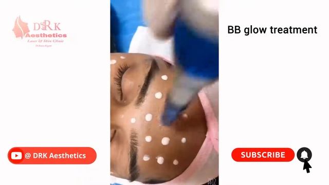 Mesotherapy for under eyes dark circles/ PRP FOR HAIR/ BB Glow Treatment смотреть онлайн