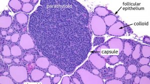 Сазонов С.В. 23. Околощитовидная железа