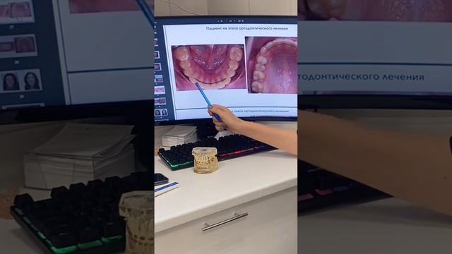 РЕТЕЙНЕРЫ - ЭТО НАВСЕГДА? смотреть онлайн