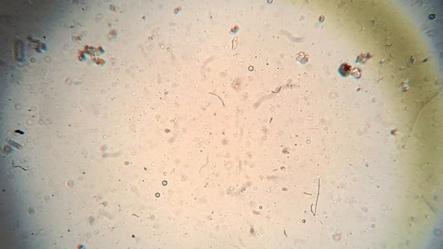 Cyclops a Microscopic Crustacean смотреть онлайн