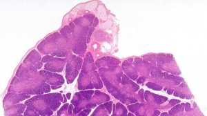 Сазонов С.В. 21. Тимус