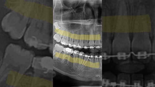 localização dos tumores odontogênicos смотреть онлайн