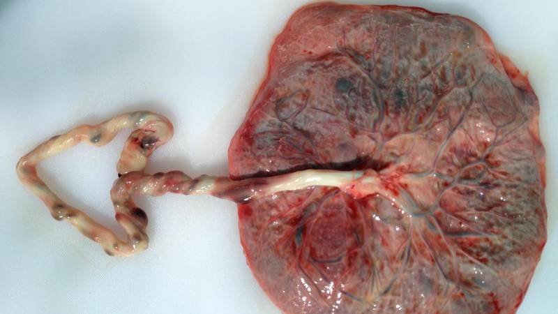 Сазонов С.В. 50. Плацента смотреть онлайн
