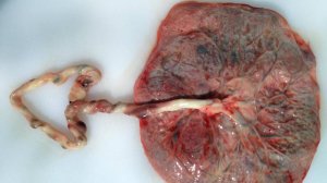 Сазонов С.В. 50. Плацента