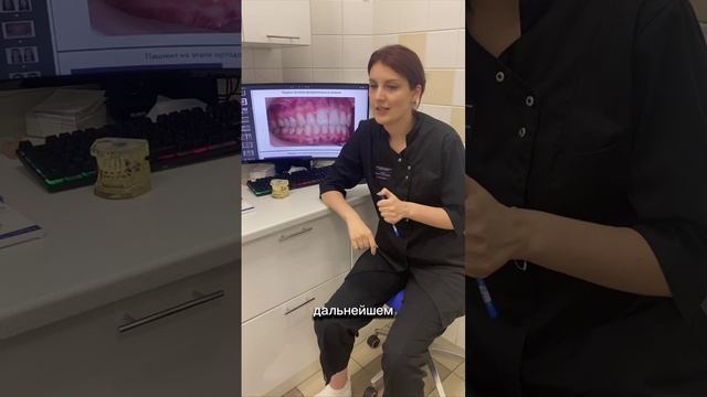 ПОЧЕМУ НУЖНО СТАВИТЬ ИМПЛАНТ СРАЗУ? смотреть онлайн