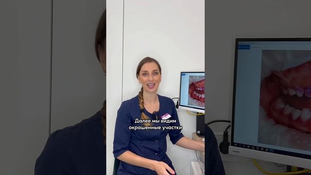 Как проверить хорошо ли ребёнок чистит зубы❓🦷 смотреть онлайн