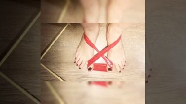 Упражнения при Hallux Valgus